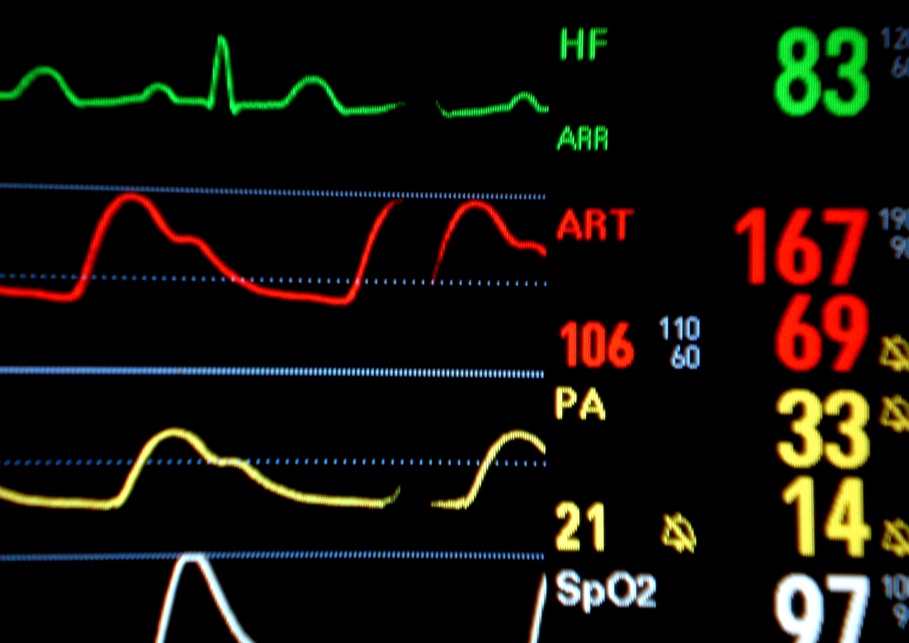 cardiac Monitor